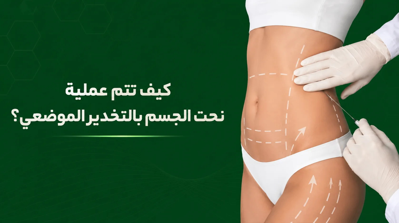 کیف تتم عملیة نحت الجسم باالتخدیر الموضعی؟